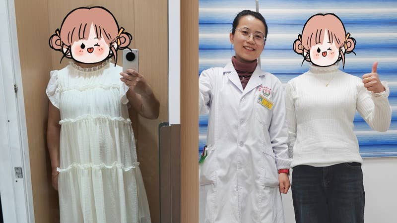 3个月减重25斤！万医体重管理门诊带你拥抱健康生活