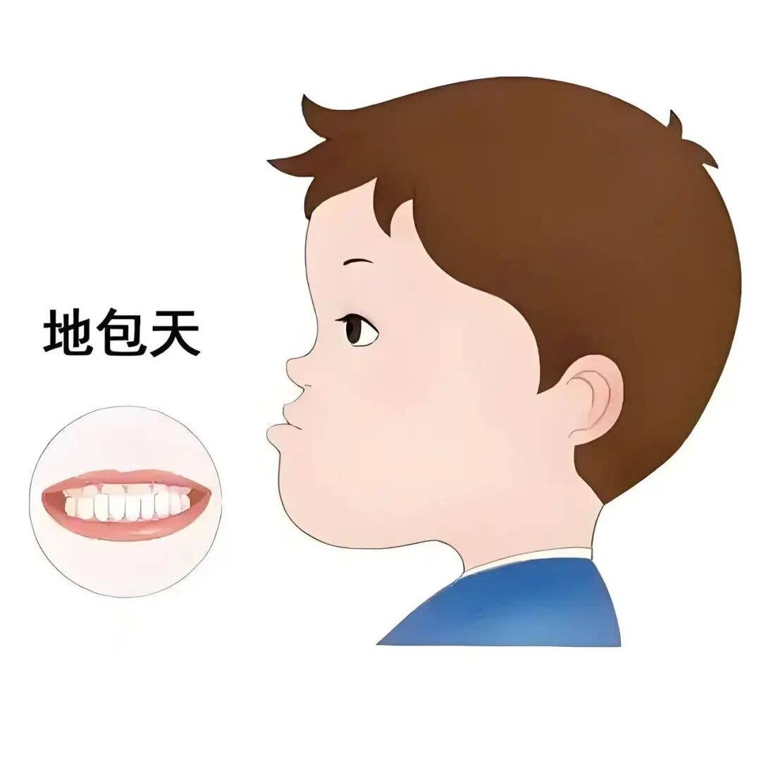 适时矫正，告别“地包天”，还孩子自信笑容！