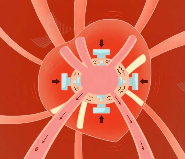 这个人体里的沉默“杀手”，正在偷偷伤害爸妈